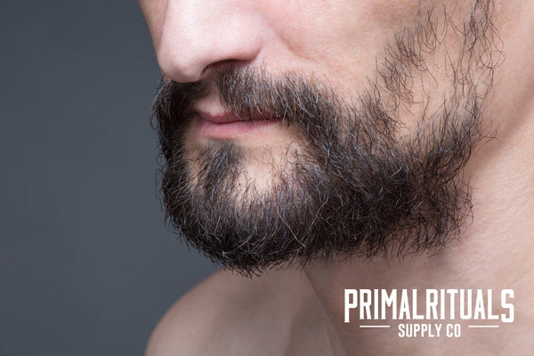 What's with my Patchy Beard?